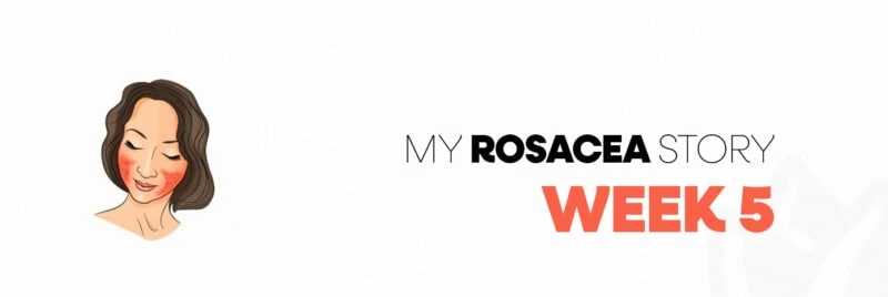 week 5 rosacea