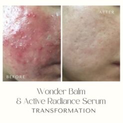 vemel-wonder-balm-active-radiance-serum