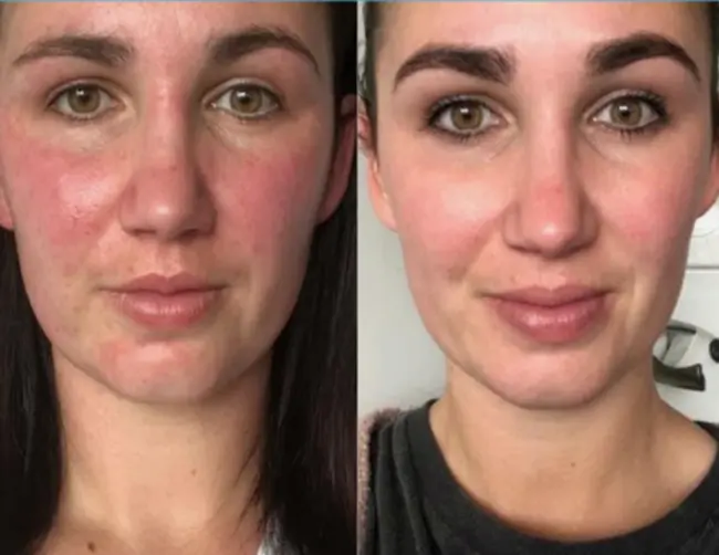 collagen elixir