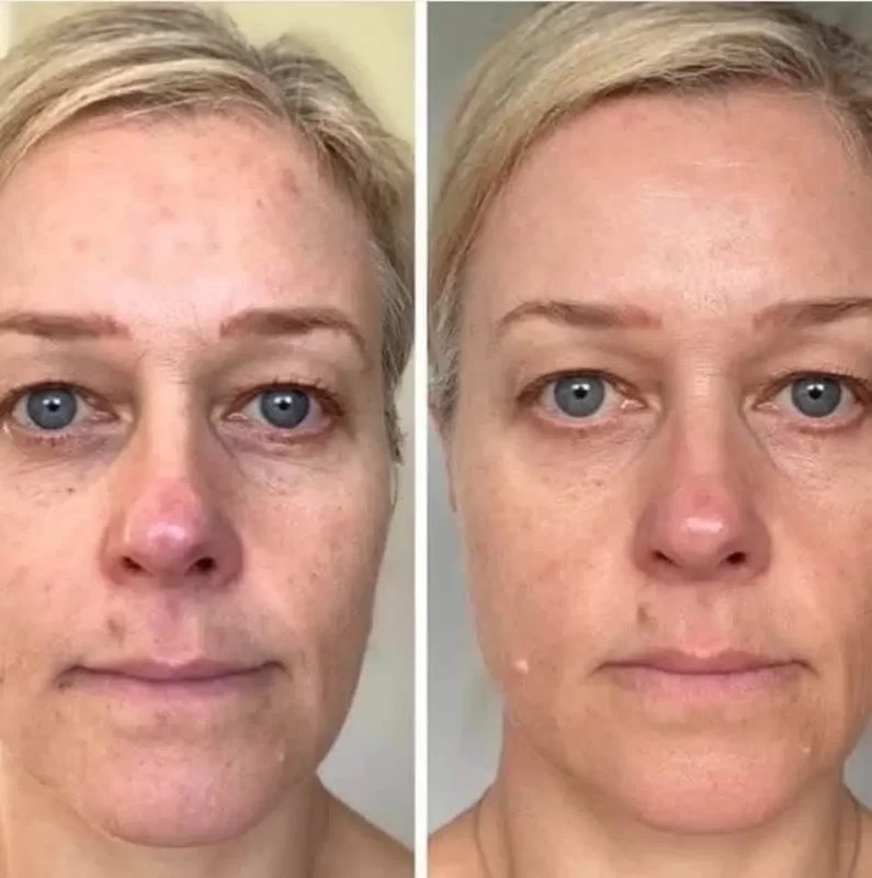 collagen elixir