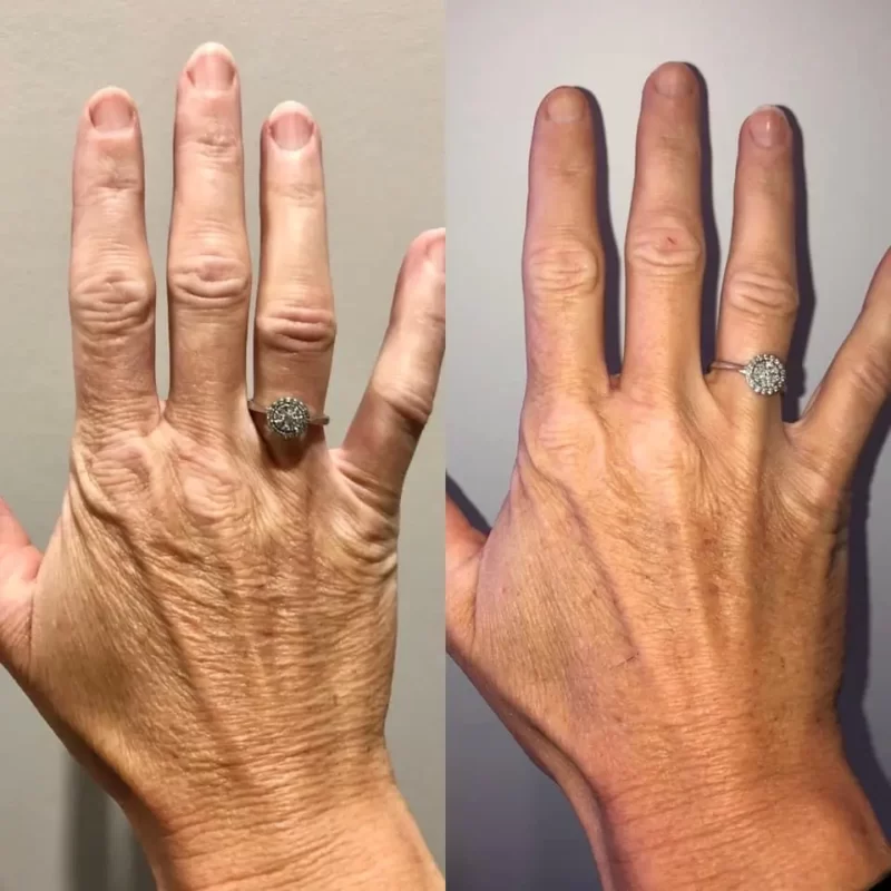 collagen elixir