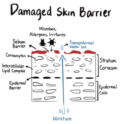 Repairing Your Skin's Barrier: How To