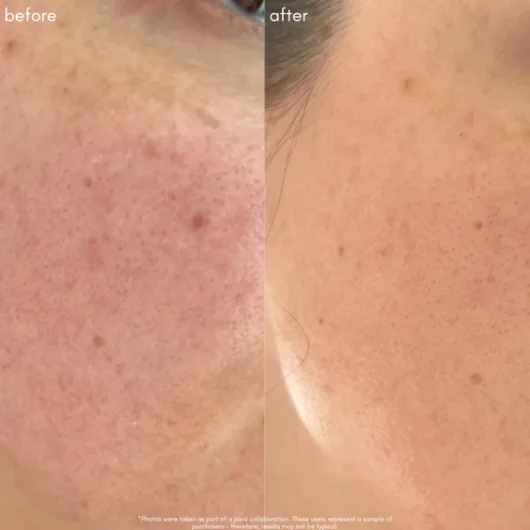 The Super Lift - concentrated vitamin c-more treatment - Image 6