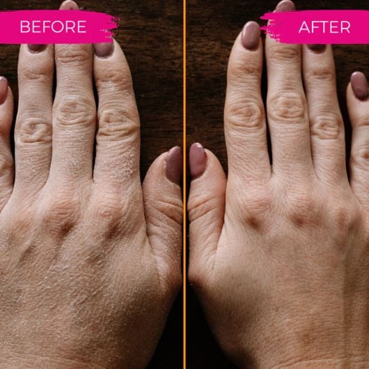 viori-peach-scrub-before-after