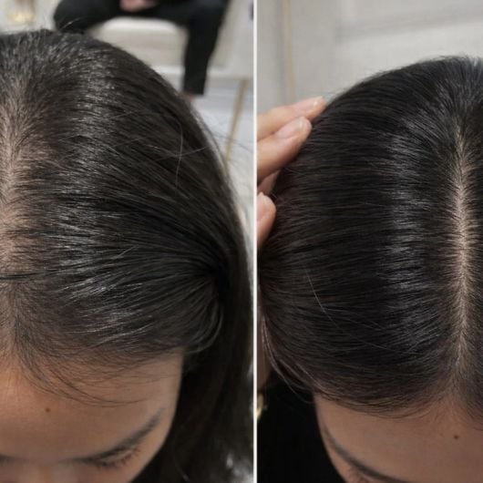 viori-hair-beauty-vitamin-6